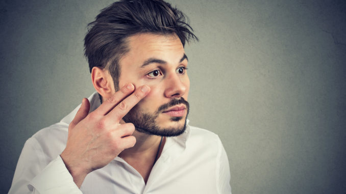 Young man pulling down eyelid checking his eye looking in mirrow feels unwell has black circles