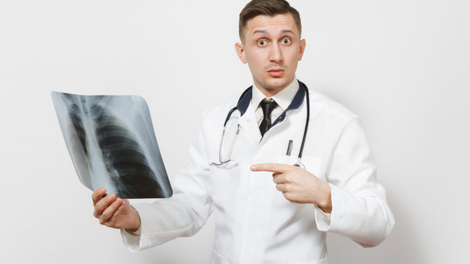 Perplexed focused doctor man with X-ray of lungs