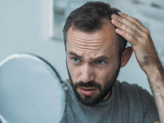 upset middle aged man with alopecia looking at mirror hair loss concept